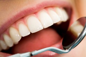 Prophylaxe beim Zahnarzt